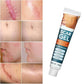 Silicone Scar Removal Gel – Fast-Absorbing Scar Treatment Gel for Smoother-Looking Skin