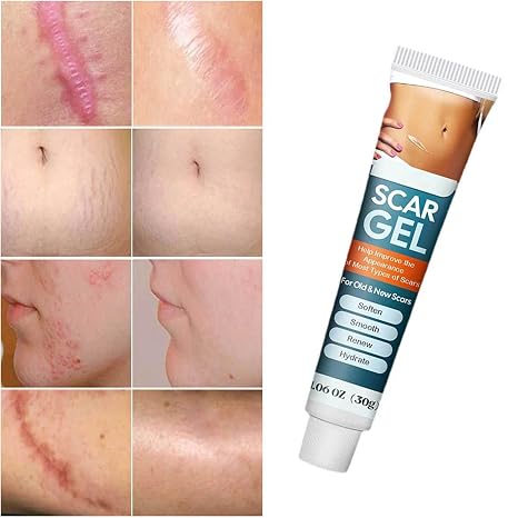 Silicone Scar Removal Gel – Fast-Absorbing Scar Treatment Gel for Smoother-Looking Skin