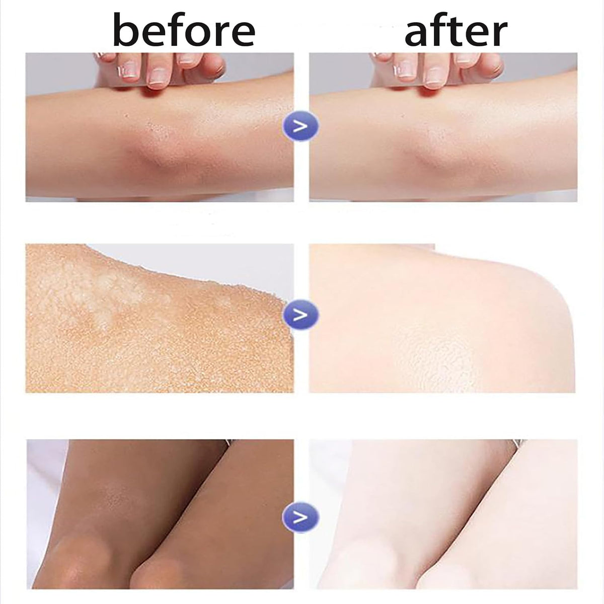 OMENFEE Japanese Whitening Body Lotion 150g | Hydrating & Brightening