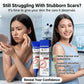silicone-scar-removal-gel-scar-treatment